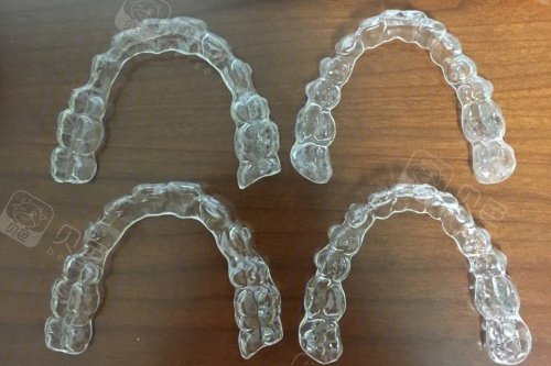 国产dr都有哪些品牌隐形牙套有哪些品牌，进口有隐适美、Spark，国产含正雅、时代天使等！_https://www.jmylbn.com_新闻资讯_第5张