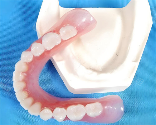 口腔吸盘怎么安装吸附式假牙的优点和缺点分别是什么呢？一文读懂“吸盘式”假牙的利与弊_https://www.jmylbn.com_新闻资讯_第1张