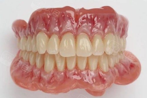 口腔吸盘怎么安装吸附式假牙的优点和缺点分别是什么呢？一文读懂“吸盘式”假牙的利与弊_https://www.jmylbn.com_新闻资讯_第2张