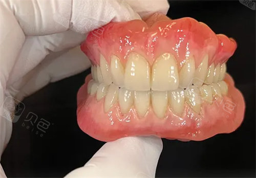 口腔吸盘怎么安装吸附式假牙的优点和缺点分别是什么呢？一文读懂“吸盘式”假牙的利与弊_https://www.jmylbn.com_新闻资讯_第3张