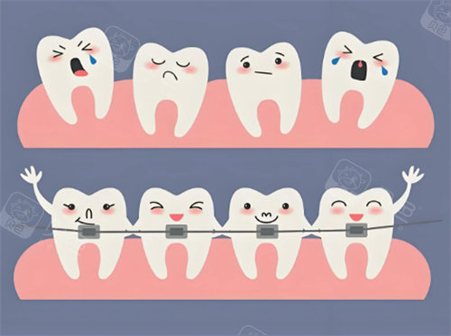 牙齿矫正卡通展示