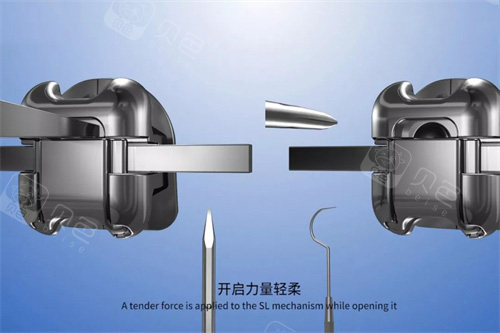 forestadent怎么读自锁托槽矫正哪个牌子好？揭秘2026自锁托槽矫正十大品牌排行榜_https://www.jmylbn.com_新闻资讯_第5张