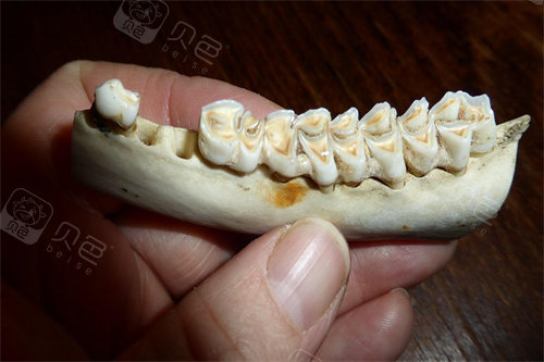 假牙模型展示
