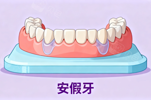 假牙安装卡通图