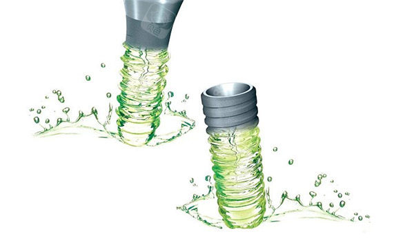 超声骨刀 哪些品牌种植牙一千多和几千的区别是什么？一文说透价格背后的真相！_https://www.jmylbn.com_新闻资讯_第7张