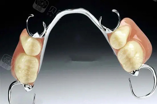 多颗活动义齿示意图