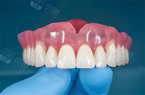 全口种植牙齿图片