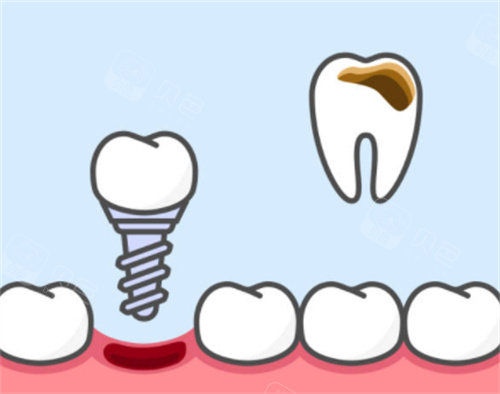 数字牙片机怎么用深圳佑诺口腔门诊部怎么样？南山看牙必读,千平数字化诊所的真实体验报告_https://www.jmylbn.com_新闻资讯_第1张