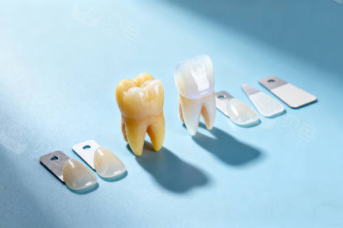 数字牙片机怎么用深圳佑诺口腔门诊部怎么样？南山看牙必读,千平数字化诊所的真实体验报告_https://www.jmylbn.com_新闻资讯_第3张