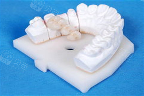 数字牙片机怎么用深圳佑诺口腔门诊部怎么样？南山看牙必读,千平数字化诊所的真实体验报告_https://www.jmylbn.com_新闻资讯_第7张