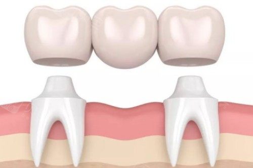 镶牙卡通展示图