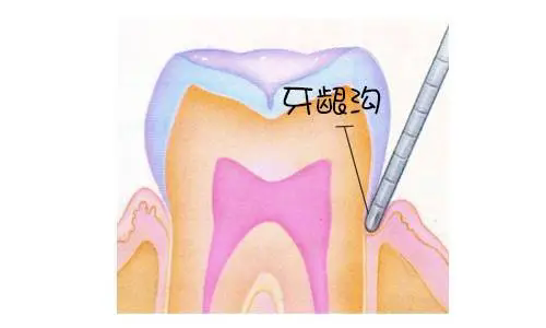 口腔修复液怎么用牙齿修复液是真的吗？什么时候上市？牙齿修复液十年内能普及吗？_https://www.jmylbn.com_新闻资讯_第4张