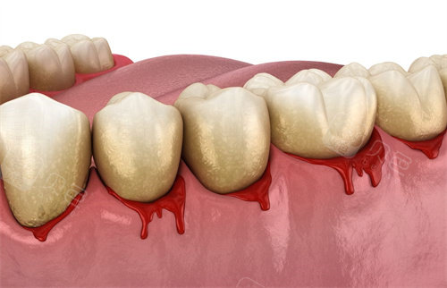 口腔修复液怎么用牙齿修复液是真的吗？什么时候上市？牙齿修复液十年内能普及吗？_https://www.jmylbn.com_新闻资讯_第3张