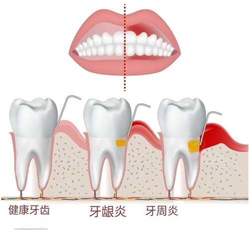 口腔修复液怎么用牙齿修复液是真的吗？什么时候上市？牙齿修复液十年内能普及吗？_https://www.jmylbn.com_新闻资讯_第1张