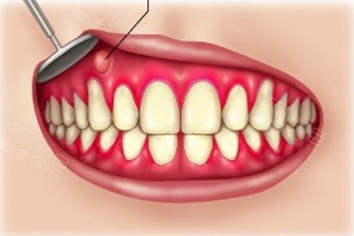 口腔修复液怎么用牙齿修复液是真的吗？什么时候上市？牙齿修复液十年内能普及吗？_https://www.jmylbn.com_新闻资讯_第5张