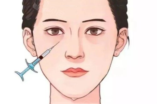 眼部注射卡通图