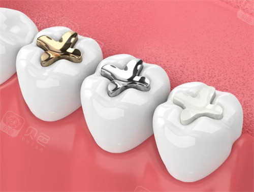 补牙后避免吃哪些食物？远离过冷过热辛辣刺激，防止刺激牙髓引发酸痛