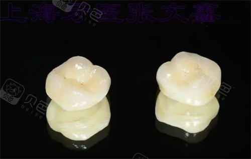 全瓷牙里面发臭怎么办？可能是继发龋或牙龈发炎，建议尽快复诊全瓷牙