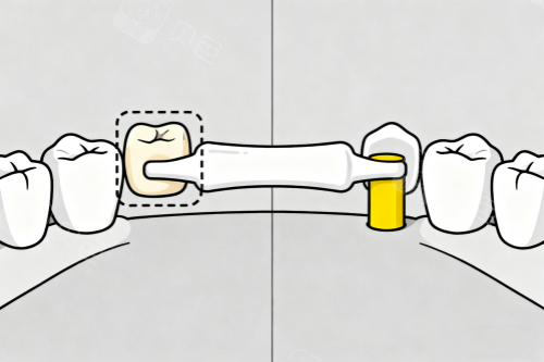 广州镶牙必看！这三家医院技术设备双保障