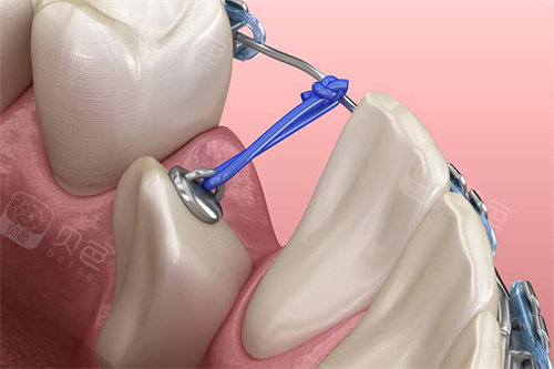 麻城看牙哪家好？智达口腔入选本地口碑好的三大牙科，附地址、电话及价格表