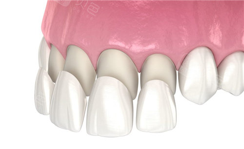 震惊！襄阳人看牙都偷偷去这几家，种植牙价格比医院还便宜