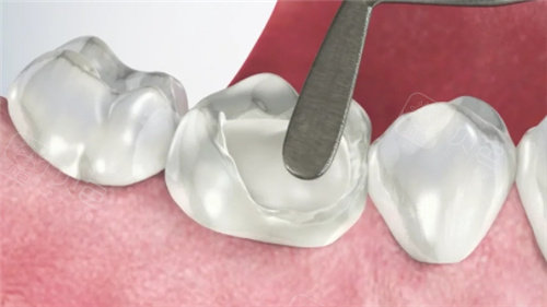 河源紫金县牙科诊所哪家牙科好？恒信口腔正规靠谱，30年老店服务超多人！