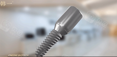 韩一种植牙好不好