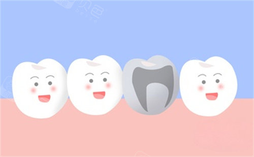 吉林市张杰口腔诊所看牙靠谱吗？去过的人都评价环境干净且不用排队在