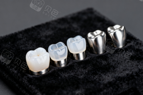 各类型牙冠展示图