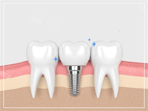 张掖华康口腔医院地址临泽北路399号！特色种植矫正+医生团队实力全汇总