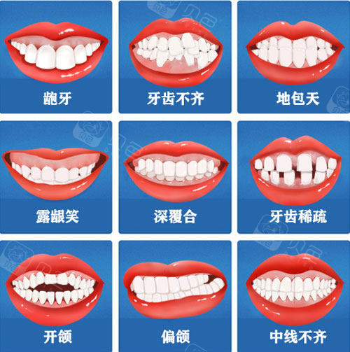 深圳罗湖牙齿矫正医院哪家好?爱康健/新安麦芽/格伦菲尔口腔整牙正畸好!