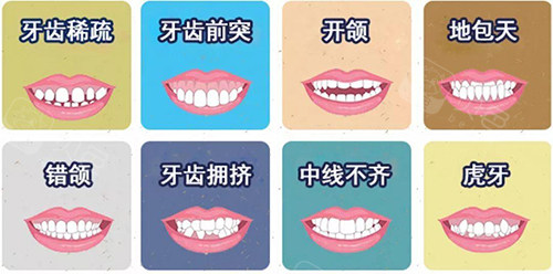 牙齿矫正不同适应症漫画图