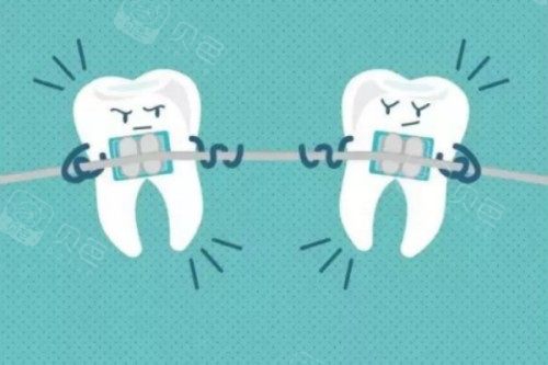 牙齿矫正卡通图
