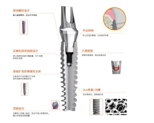 种植牙在线询问:24小时人工牙科问询|各地正规种牙医院免费挂号
