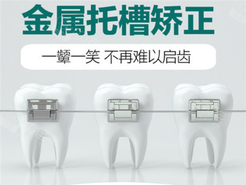 金属托槽矫正图