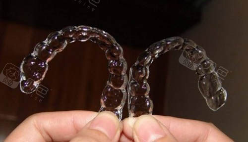 一组隐形牙套照片