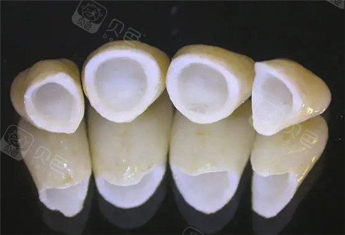 全瓷牙咬东西用不上力正常吗？亲身体验解答，咀嚼力修养稳固耐用省心