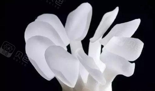 牙齿树脂贴面示意图