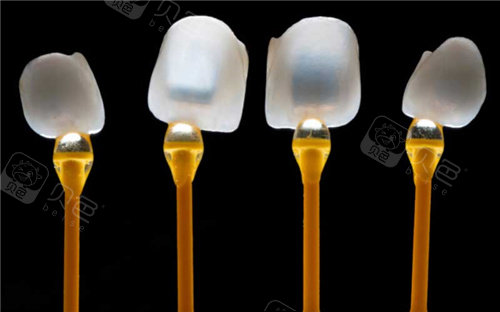 牙齿贴面透光度