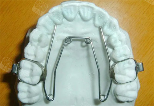 四眼簧扩弓器模型