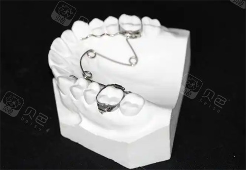 四眼簧扩弓器价格