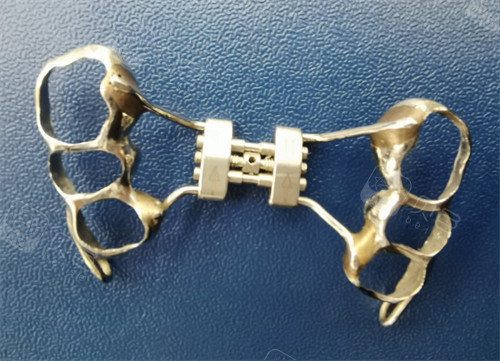 Hyrax扩弓器怎么样