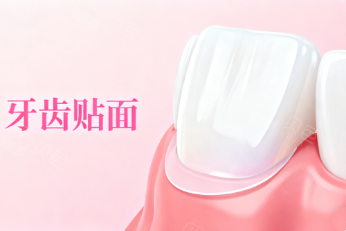 牙贴面卡通图片一览