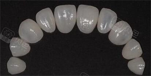 牙贴面做完变龅牙？3招拯救翻车术例！选对材料和技师比价格重要100倍！