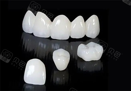 六颗门牙全瓷牙血泪史！戴牙3年才懂：自然度/咬合/价格这些坑要知道！