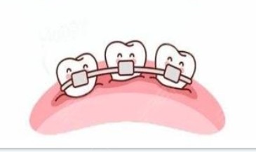 隐形牙齿和传统牙齿矫正器展示图