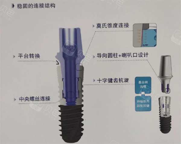 威高wego种植牙细节植体照片