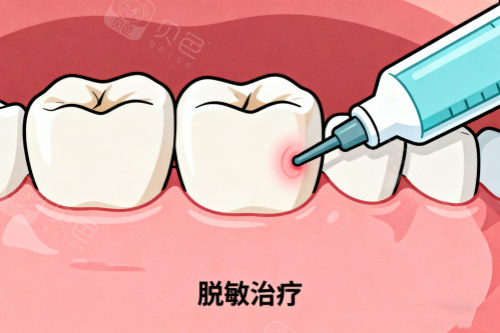 牙齿敏感治疗卡通图