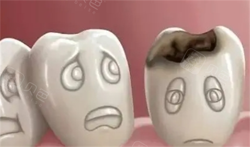 烂牙齿动画展示