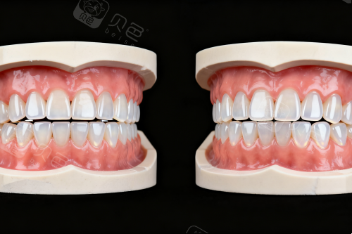 牙齿模型展示图